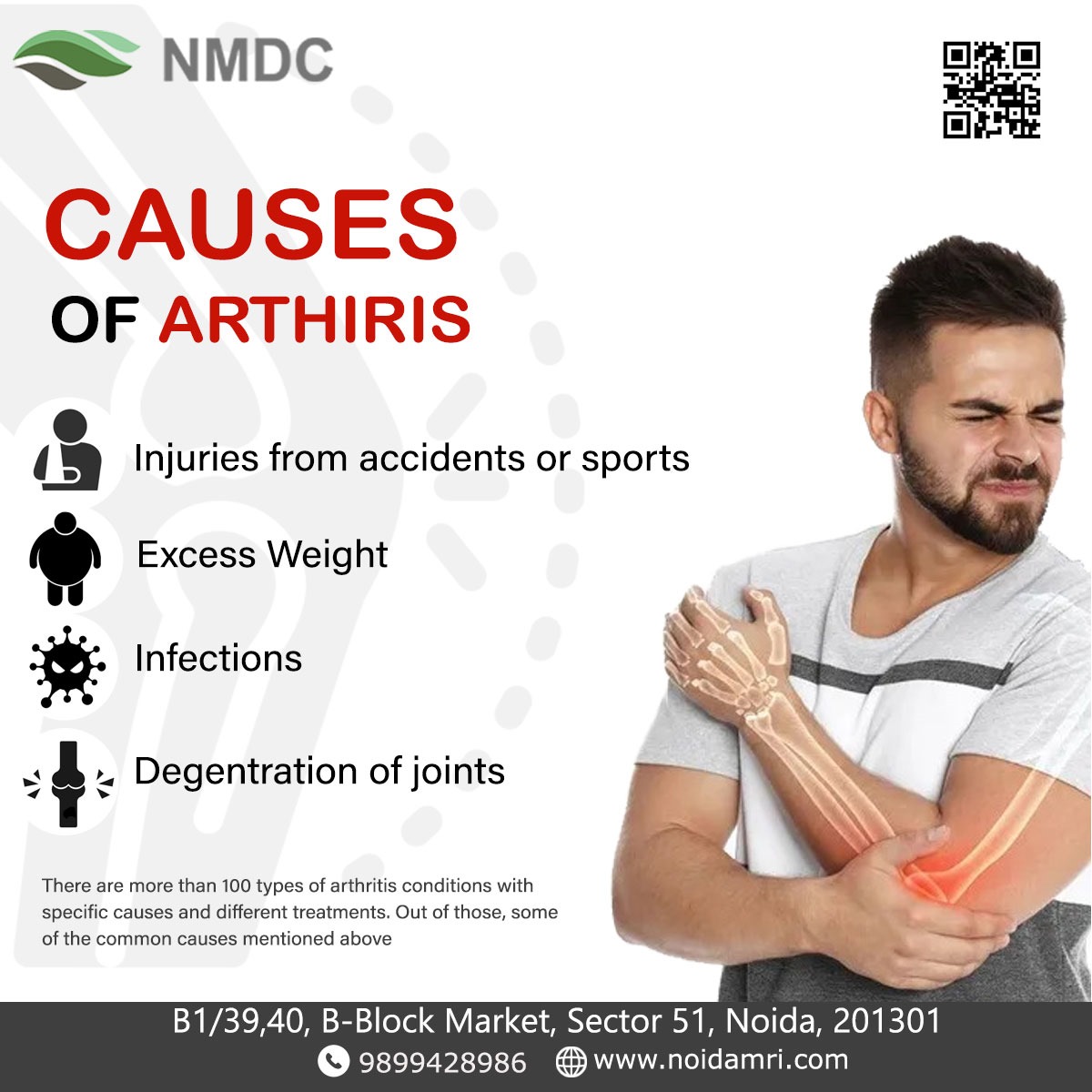 Causes of Arthritis