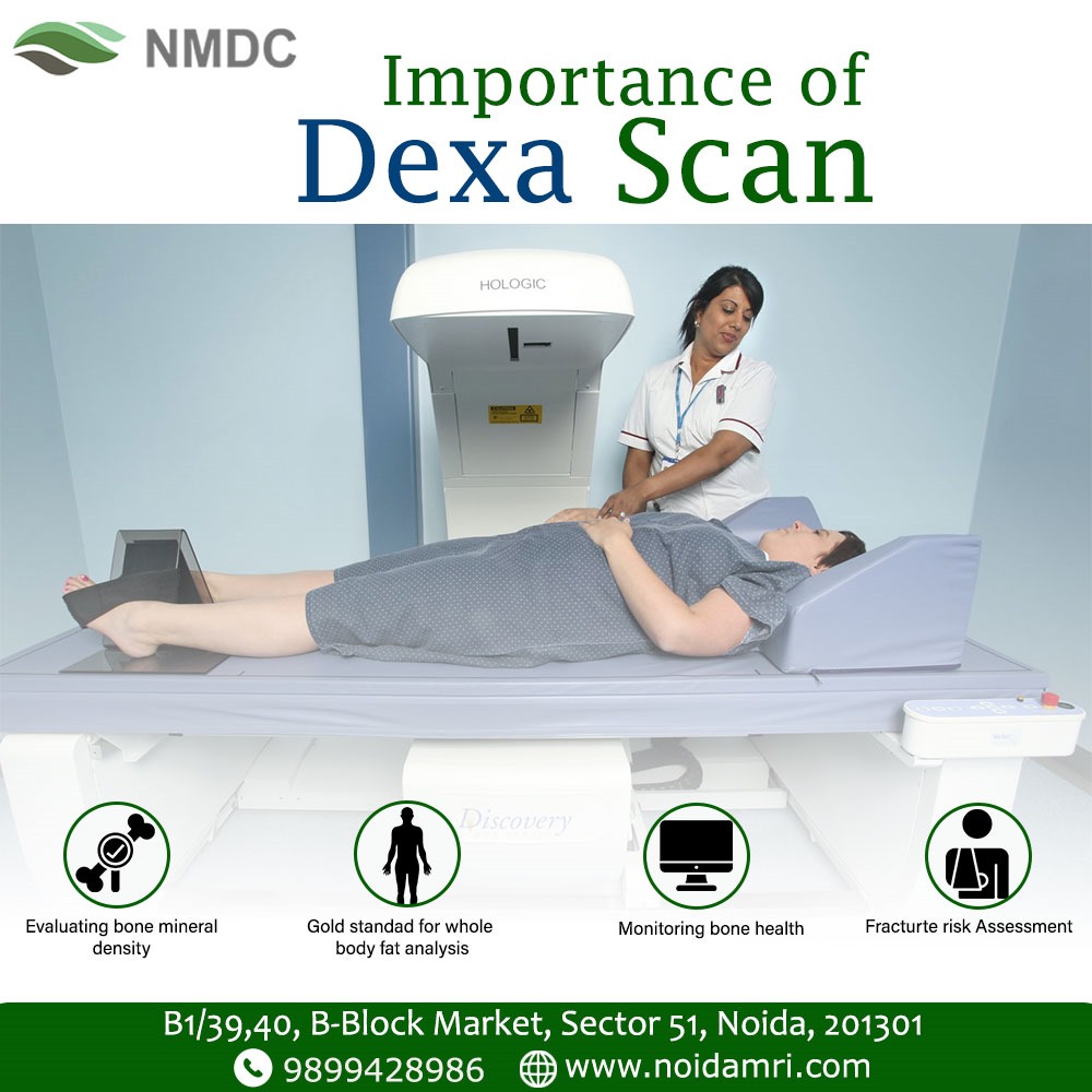 Importance of Dexa Scan