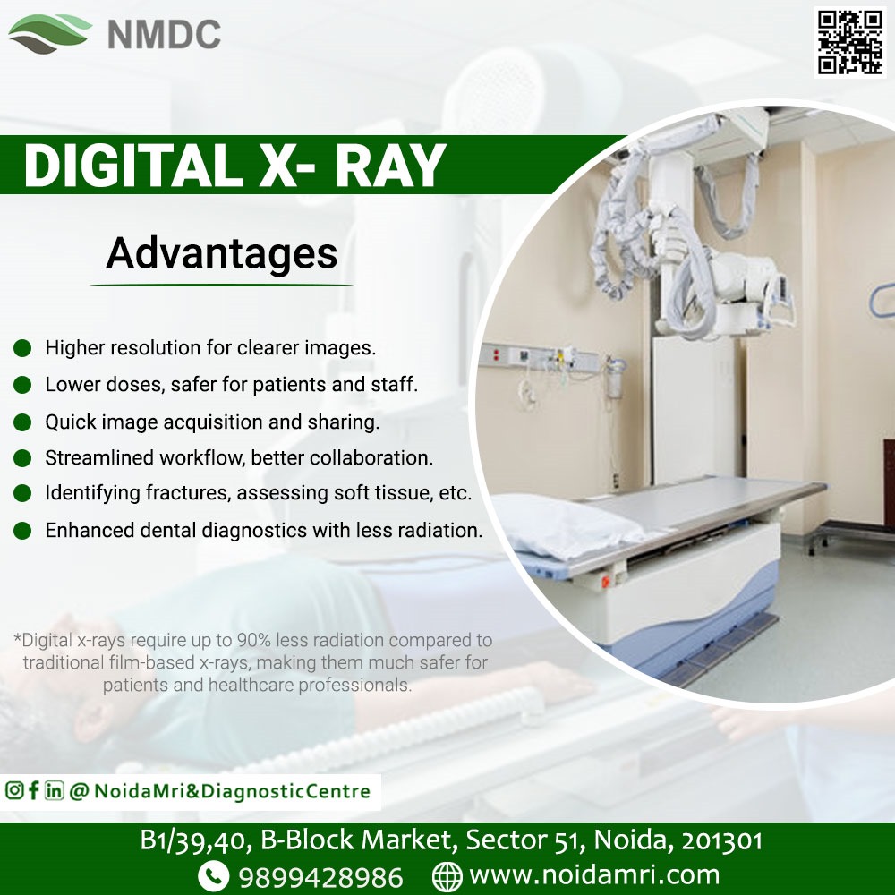 Digital X-Ray Advantages